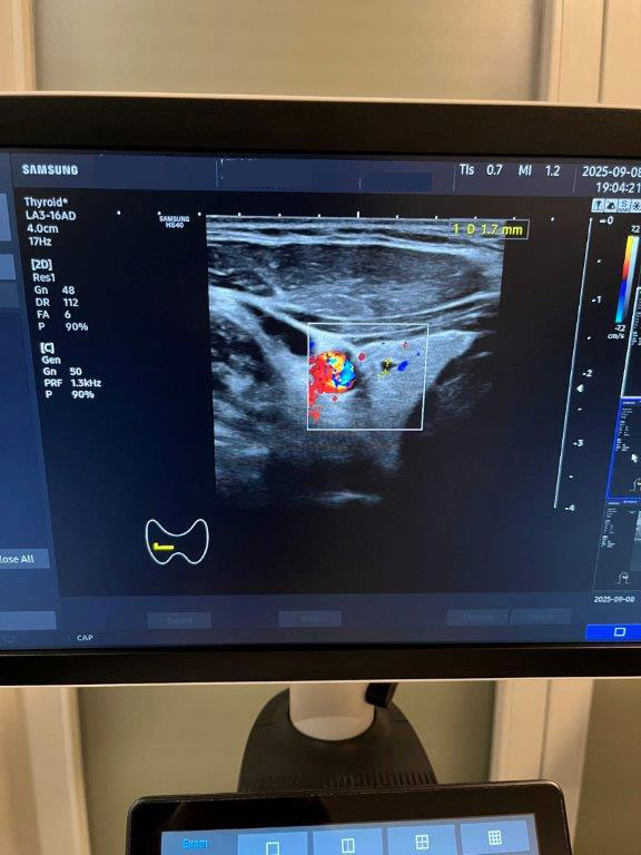 Használt HS40 ultrahang készülék négy vizsgálófejjel szülészeti, nőgyógyászati és radiológiai célra Használt HS40 ultrahang készülék négy vizsgálófejjel szülészeti, nőgyógyászati és radiológiai célra