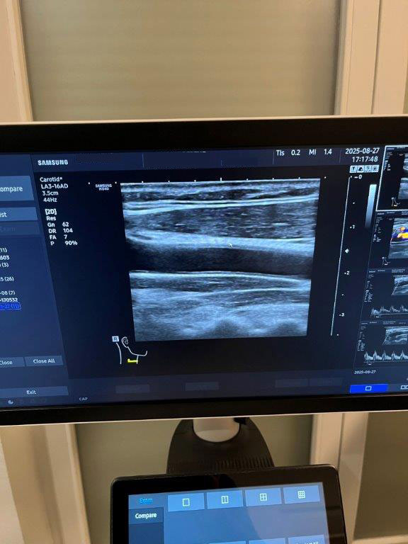 Használt HS40 ultrahang készülék négy vizsgálófejjel szülészeti, nőgyógyászati és radiológiai célra Használt HS40 ultrahang készülék négy vizsgálófejjel szülészeti, nőgyógyászati és radiológiai célra