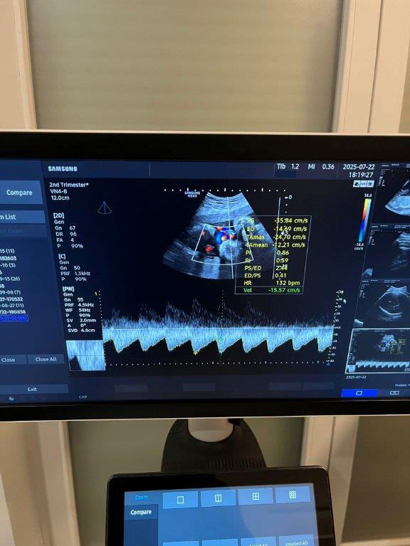 Használt HS40 ultrahang készülék négy vizsgálófejjel szülészeti, nőgyógyászati és radiológiai célra Használt HS40 ultrahang készülék négy vizsgálófejjel szülészeti, nőgyógyászati és radiológiai célra