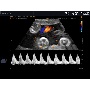 SonoAce R7 köldökzsinór színes Doppler képe