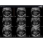 SonoAce R7 3DXI képe