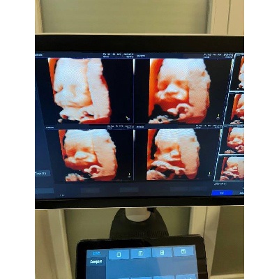 Használt Samsung HS40 2D/ 3D/ 4D/ 5D ultrahang készülék