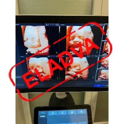 Használt Samsung HS40 2D/ 3D/ 4D/ 5D ultrahang készülék