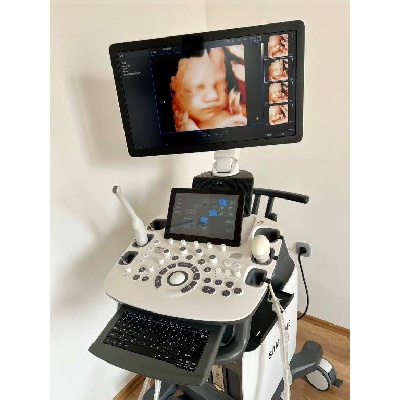 Használt Samsung HS50 típusú 2D/ 3D/ 4D/ 5D ultrahang készülék két vizsgálófejjel